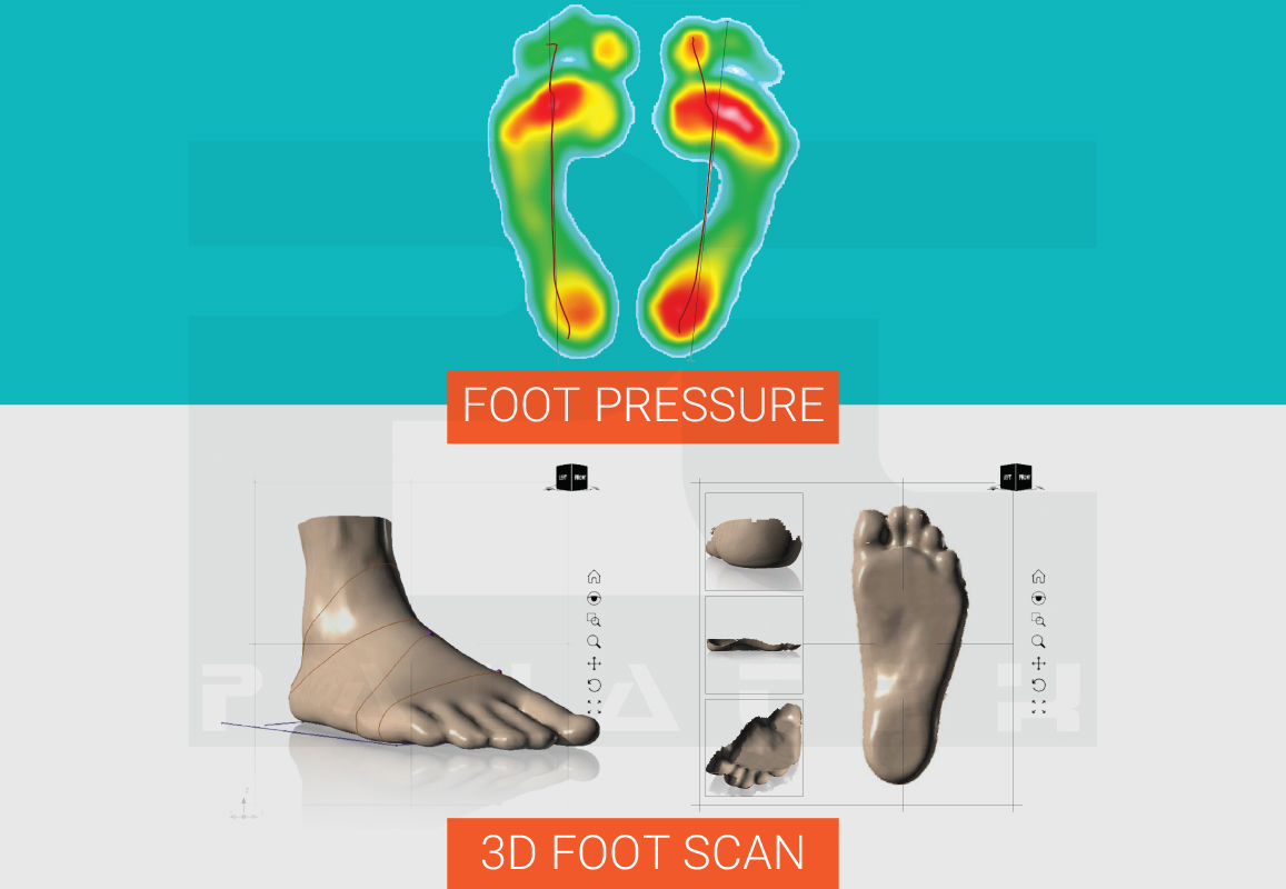 Foot Scanner Types Advantages and Disadvantages PayaTek