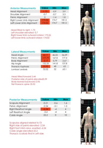 Posture Analysis report
