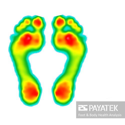 foot pressure scanner, foot scan