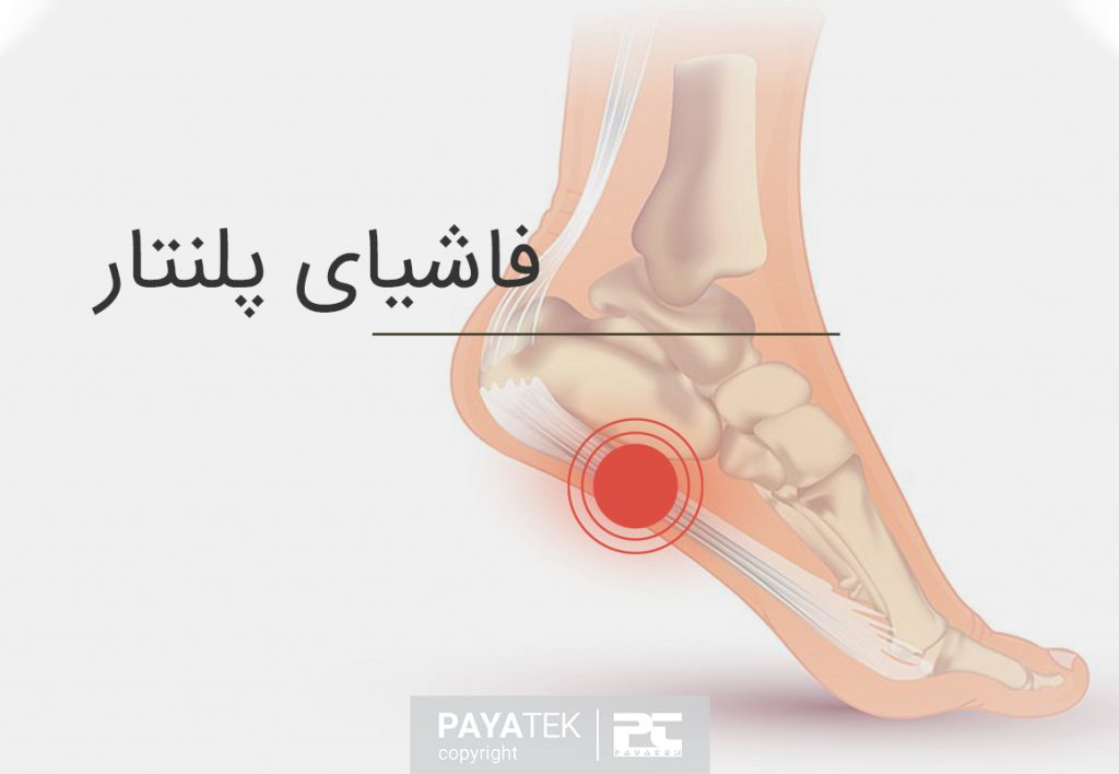 فاشیا پلنتار