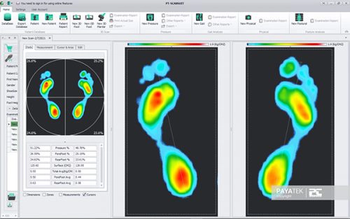 high arch foot scan