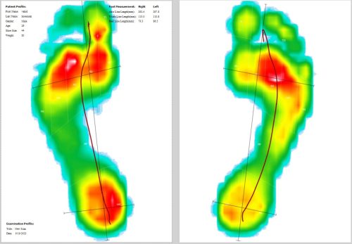 foot pressure average