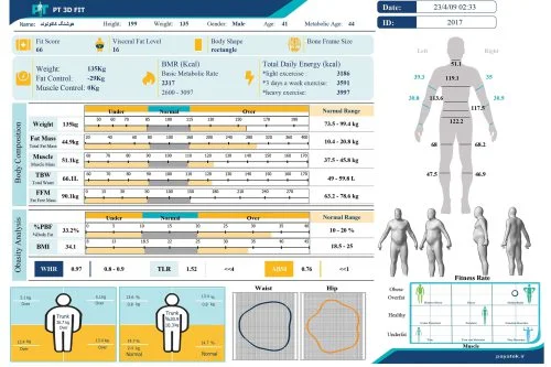 3D Body Scanners used as Postural Assessment Tool