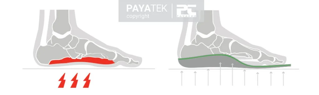 flat foot insole