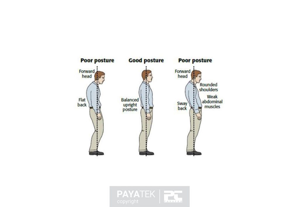 postural abnormality