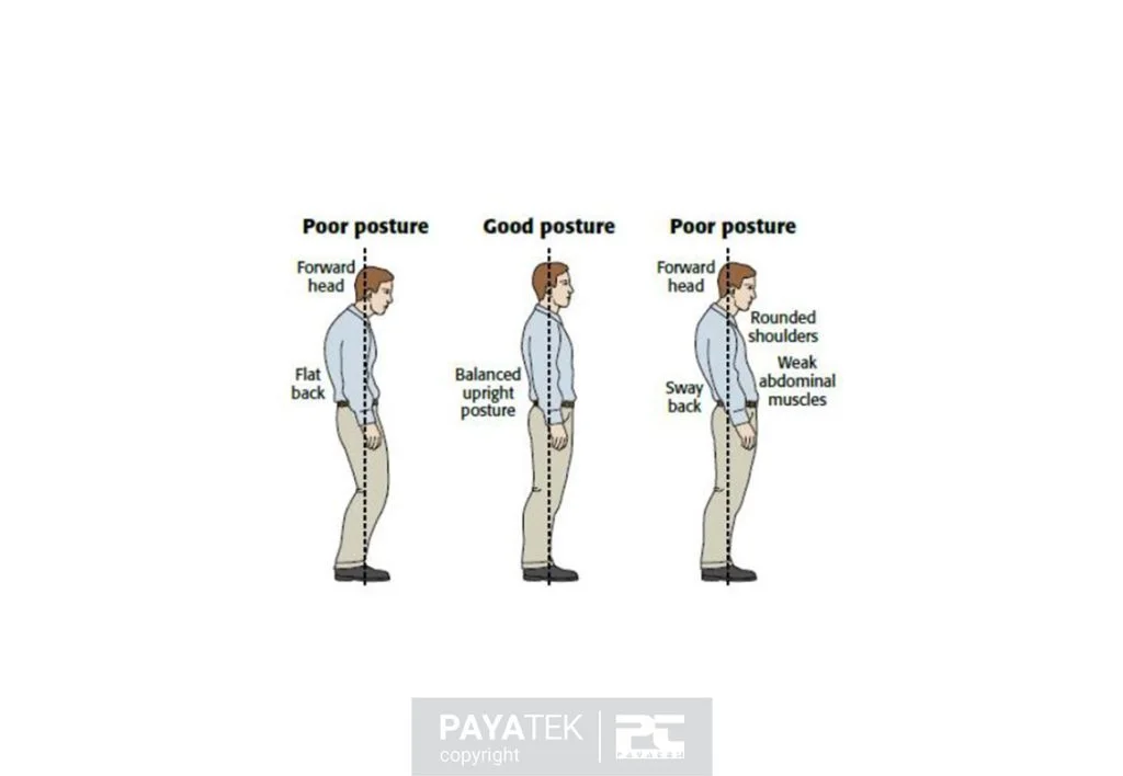 Postural Issues