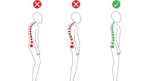 postural abnormality