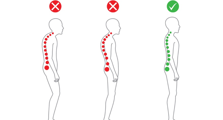 postural abnormality