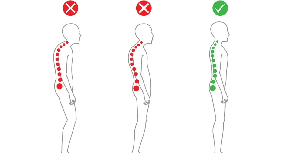 postural abnormality